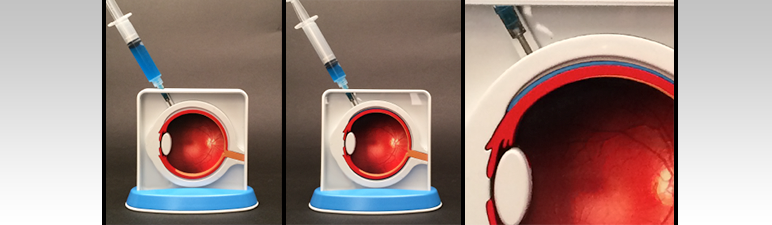 Eye Model - Pulse MDM