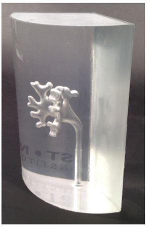 Calyceal-mold-for-kidney-stone