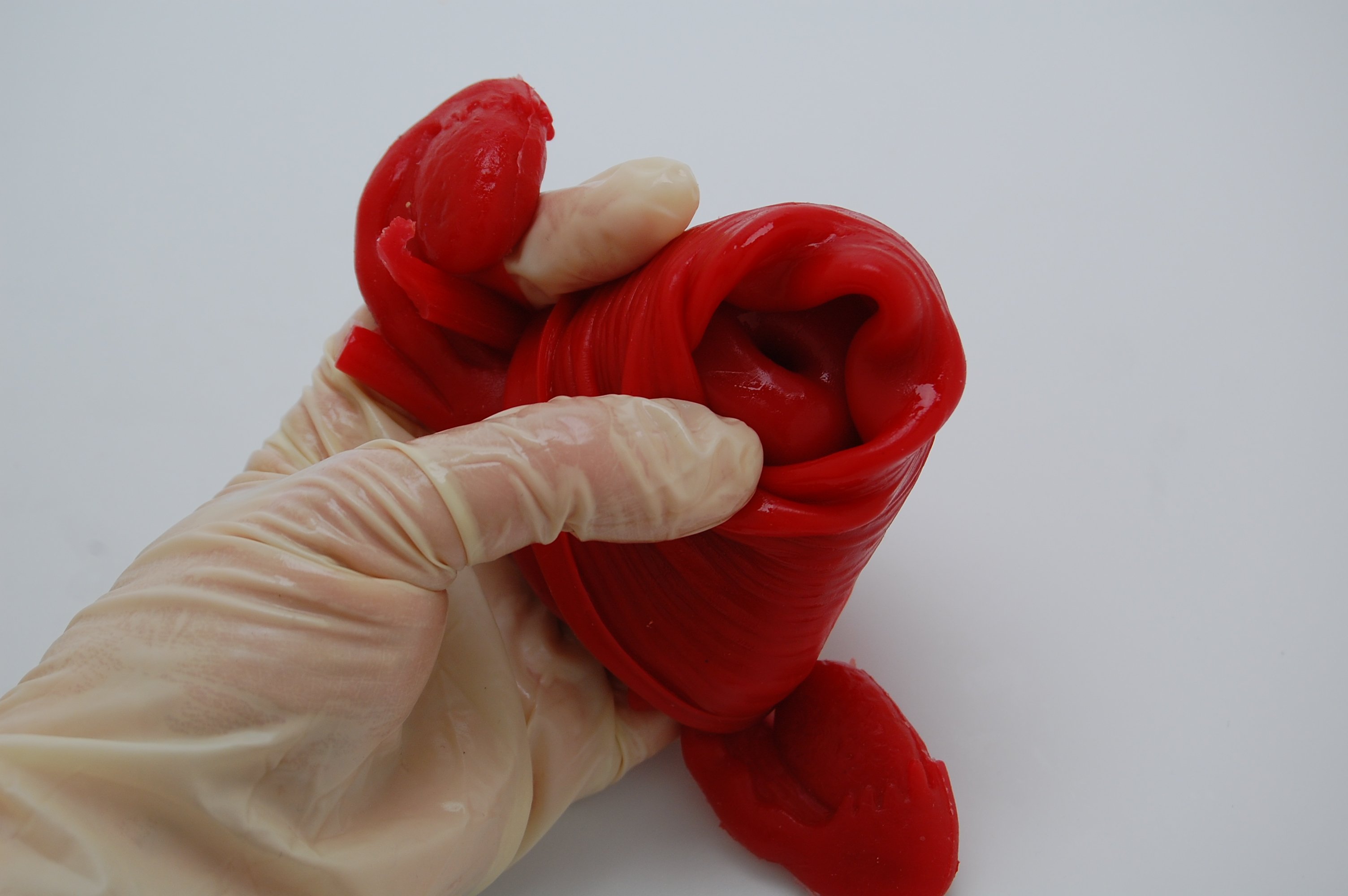 Uterine-Model-Prolapsed-with-Cervix-PULSE-MDM