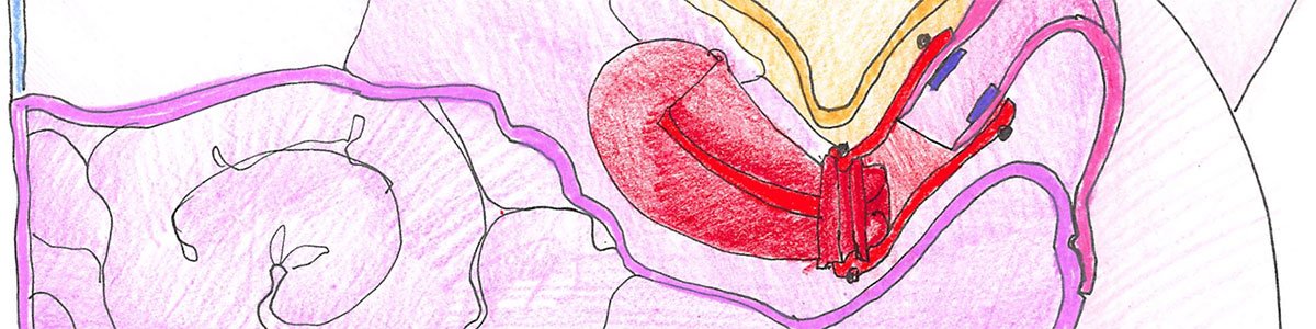 Medical model - Pulse MDM