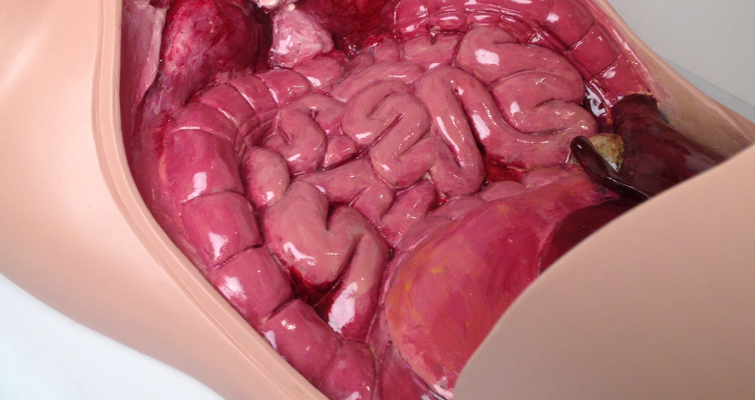 Intestines model - Pulse MDM