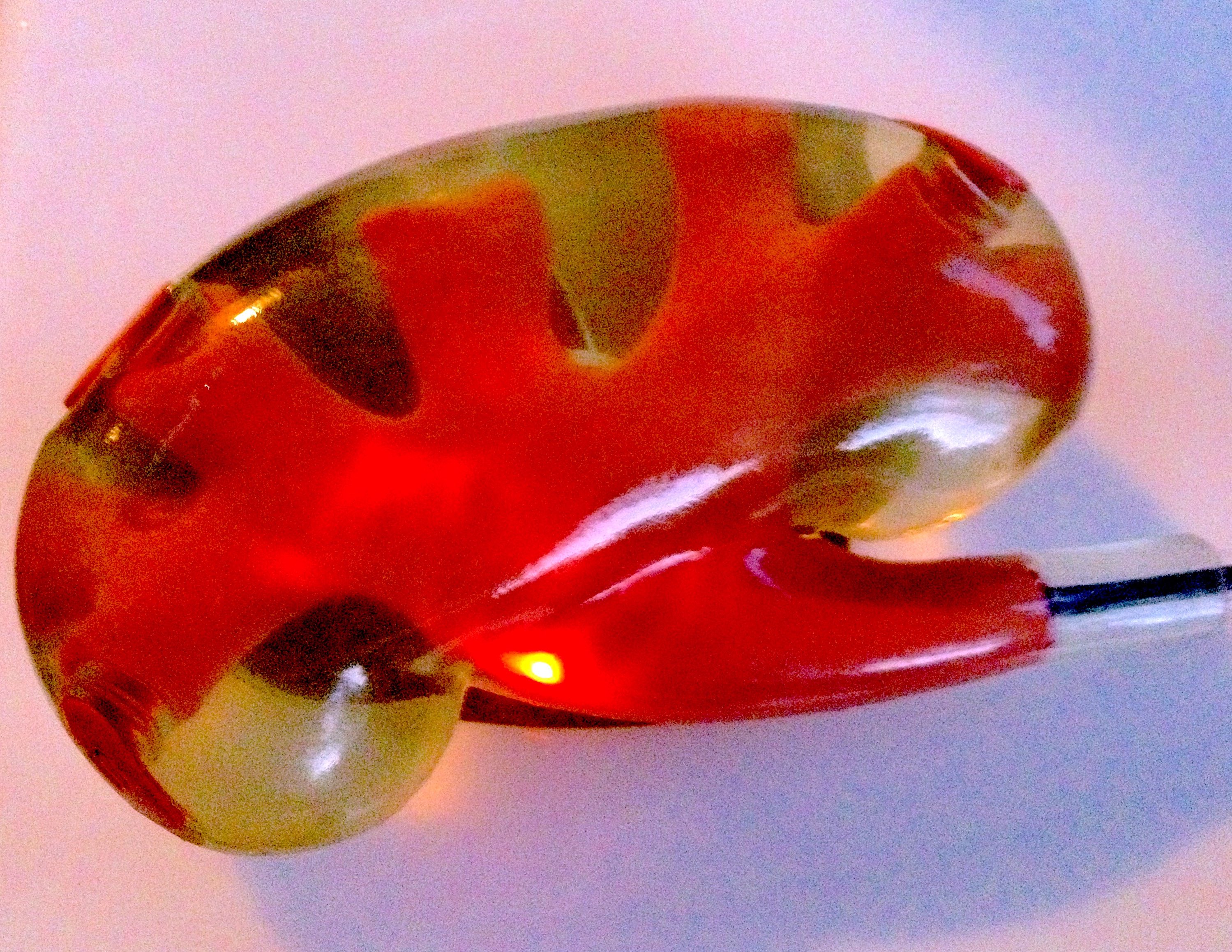 Kidney Model - Pulse MDM