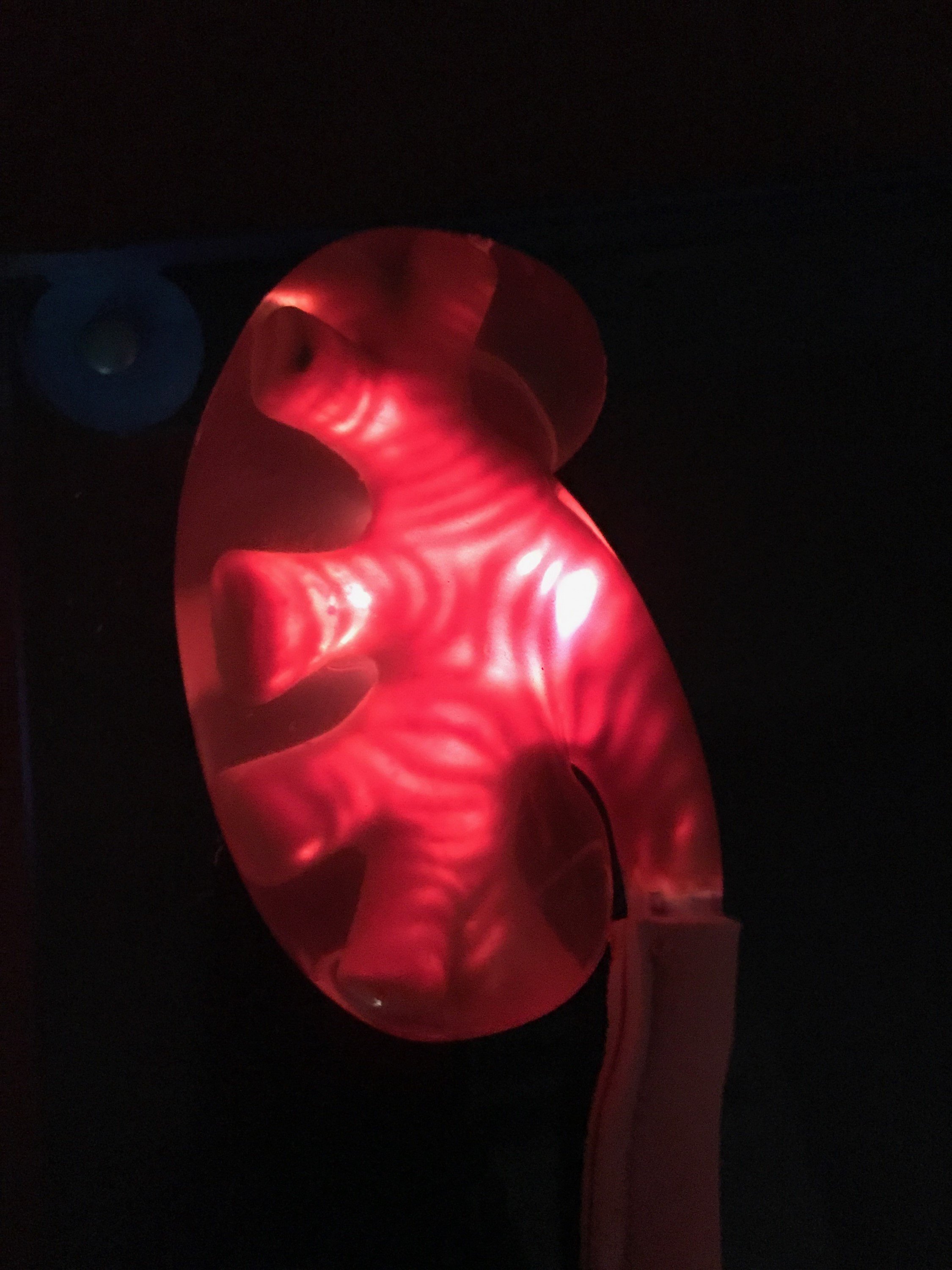 Illuminated kidney model - Pulse MDM