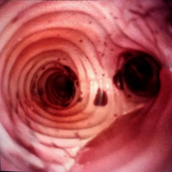 Scope view of custom PulseMDM anatomy model - Pulse MDM