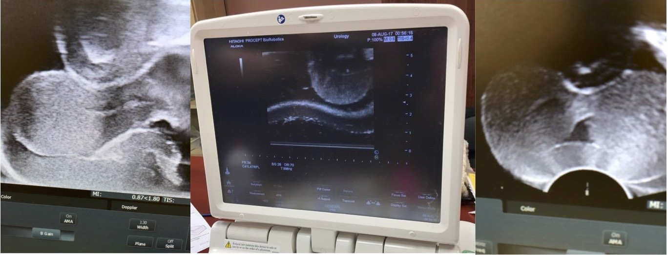 Ultrasound images of anatomy model - Pulse MDM