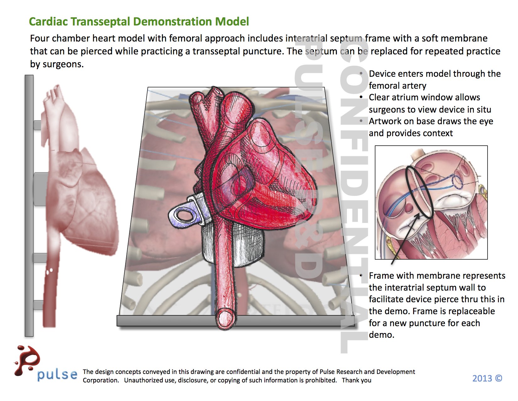 Heart - Transseptal puncture model concept - Pulse MDM