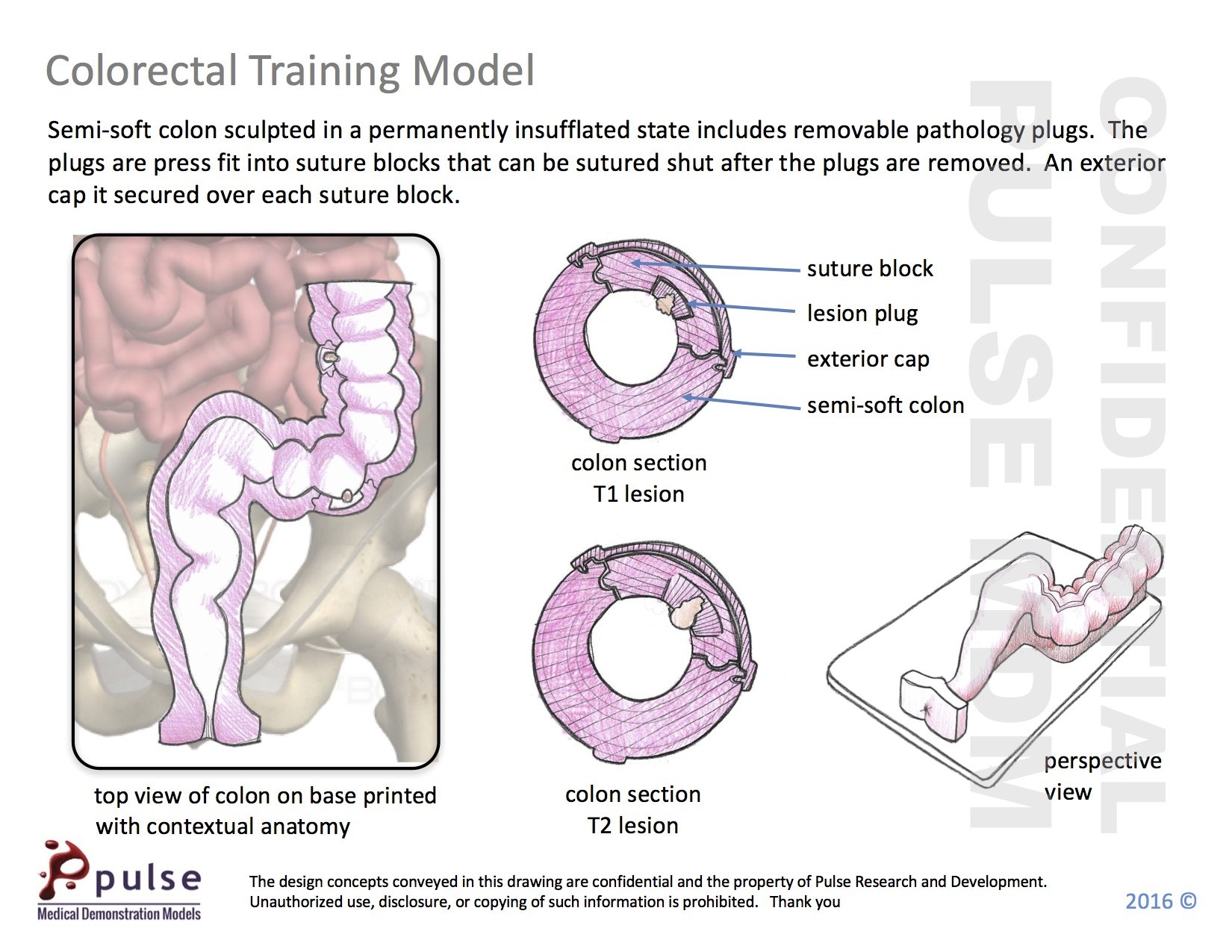 Colorectal Model Device Demonstration Concept | PULSE MDM