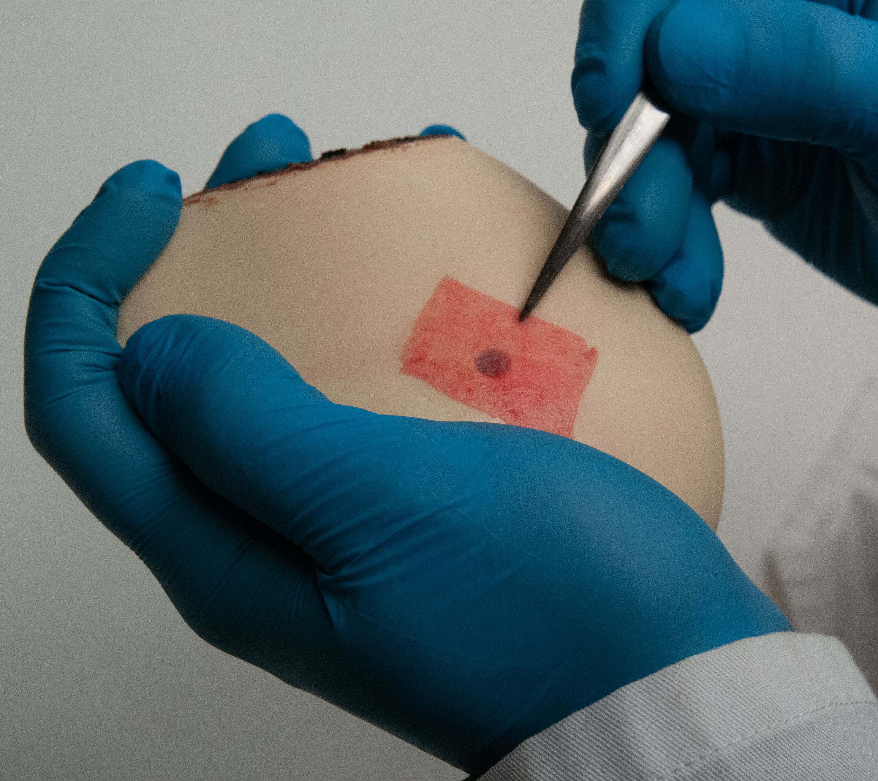 Amniotic Tissue Replica PulseMDM