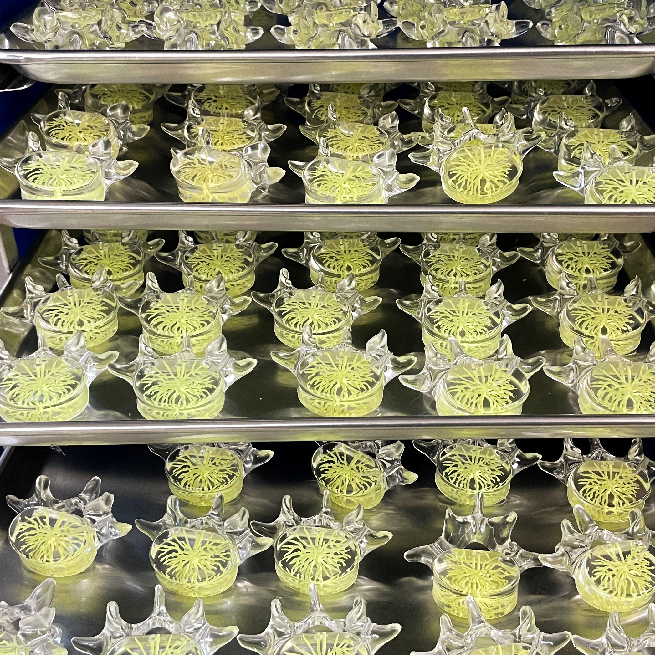 a perfectly clear vertebrae showing a delicate and accurate basivertebral nerve