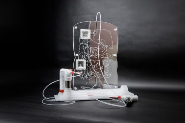 tiny spherical devices used in medical procedures to block or reduce blood flow to specific areas of the body