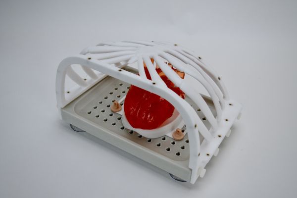 tiny spherical devices used in medical procedures to block or reduce blood flow to specific areas of the body